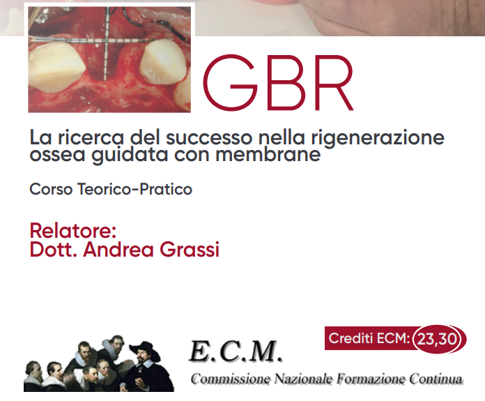 GBR – LA RICERCA DEL SUCCESSO NELLA RIGENERAZIONE OSSEA GUIDATA CON MEMBRANE